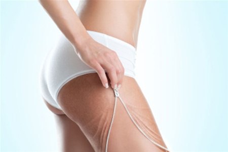 Антицелюлітна програма в Івано-Франківську